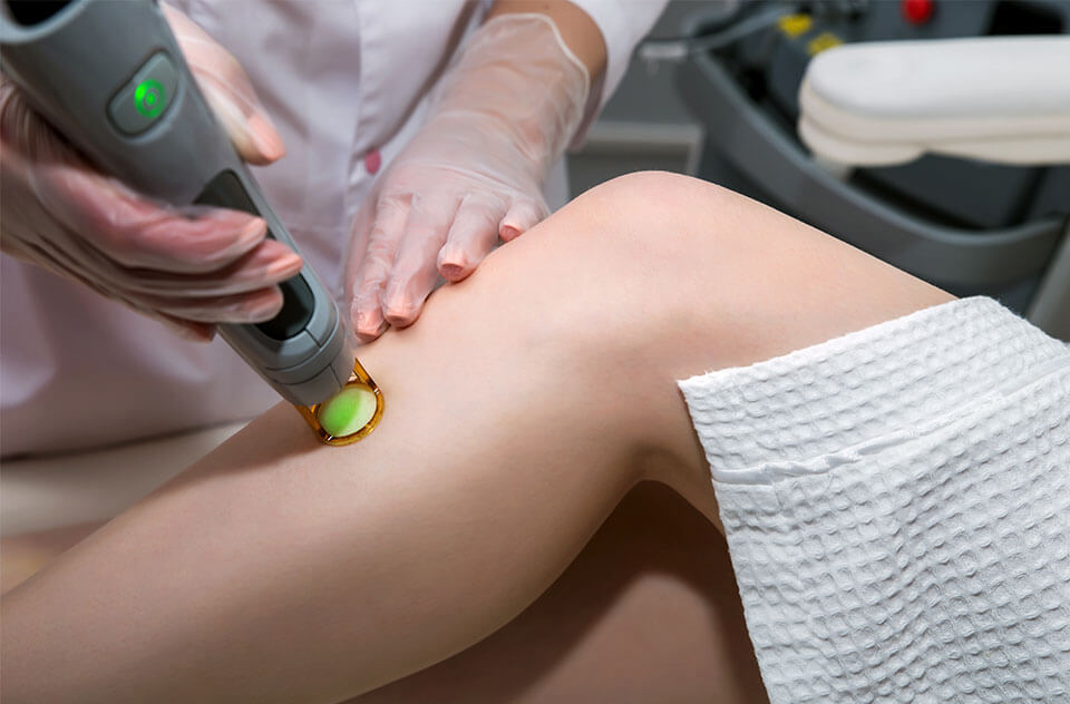 Permanent Laser Hair Removal in Adelaide - Banu Beauty Laser Clinic
